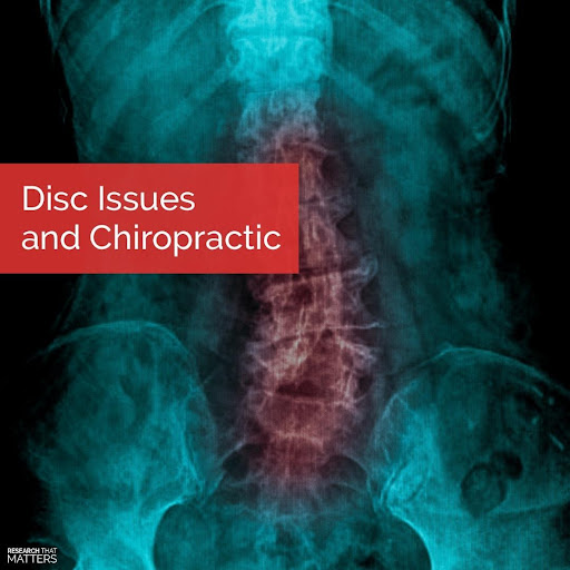 Disc issues and chiropractor